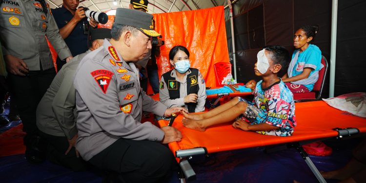 Tinjau Posko Pengungsian Erupsi Lewotobi, Kapolri Pastikan Pelayanan dan Kebutuhan Warga