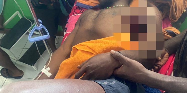 KKB Pimpinan Kalenak Murib Tembak Warga Sipil dan Bakar Honai di Puncak, Tiga Orang Meninggal Dunia